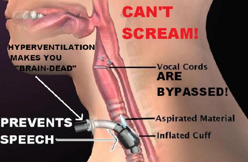 "BRAINDEATH" IS KIDNAP...MEDICAL TERRORISM/MURDER BEGINS WITH YOUR OWN